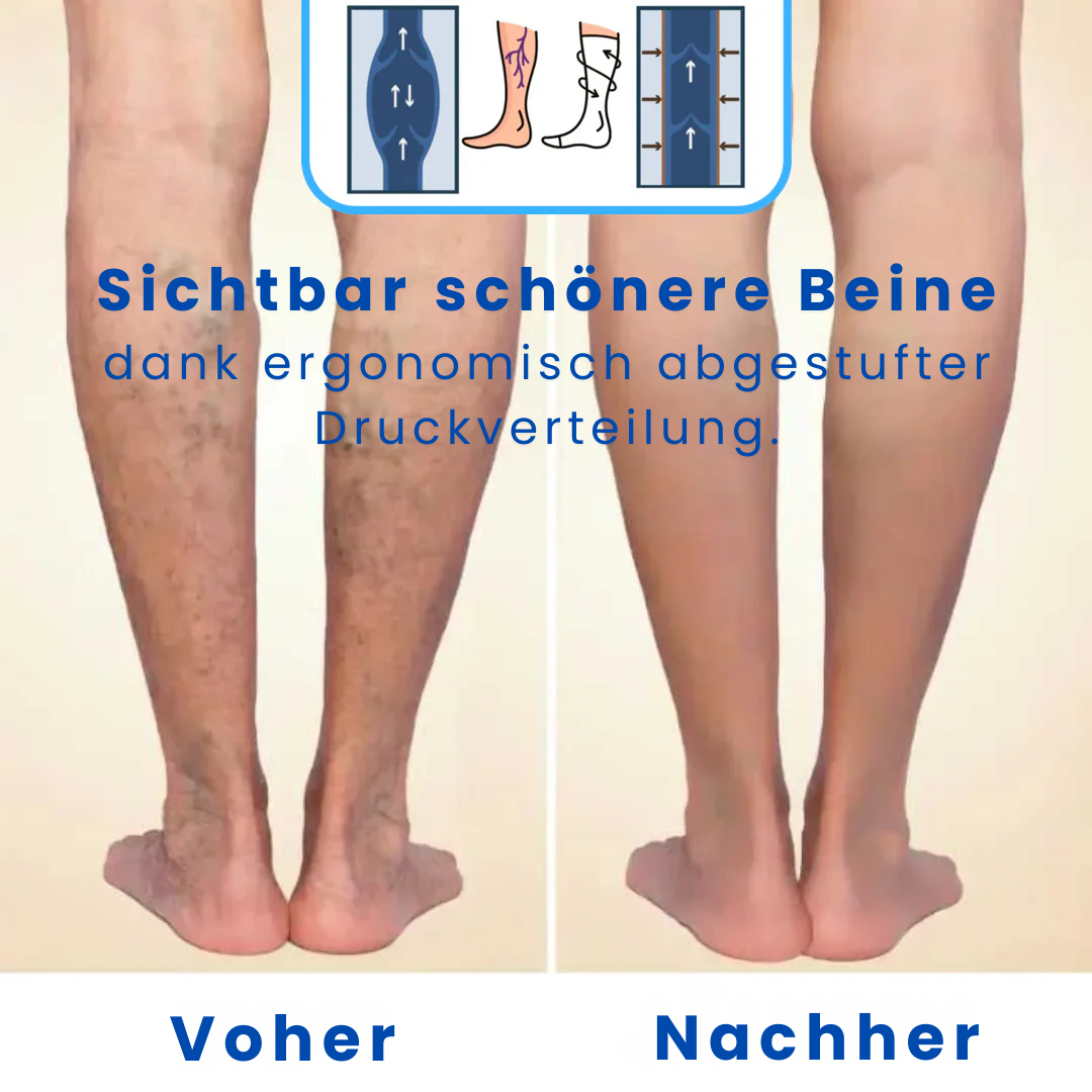 PlusFit - Kompressionsstrümpfe für breite & kräftige Waden - 20-30 mmHg