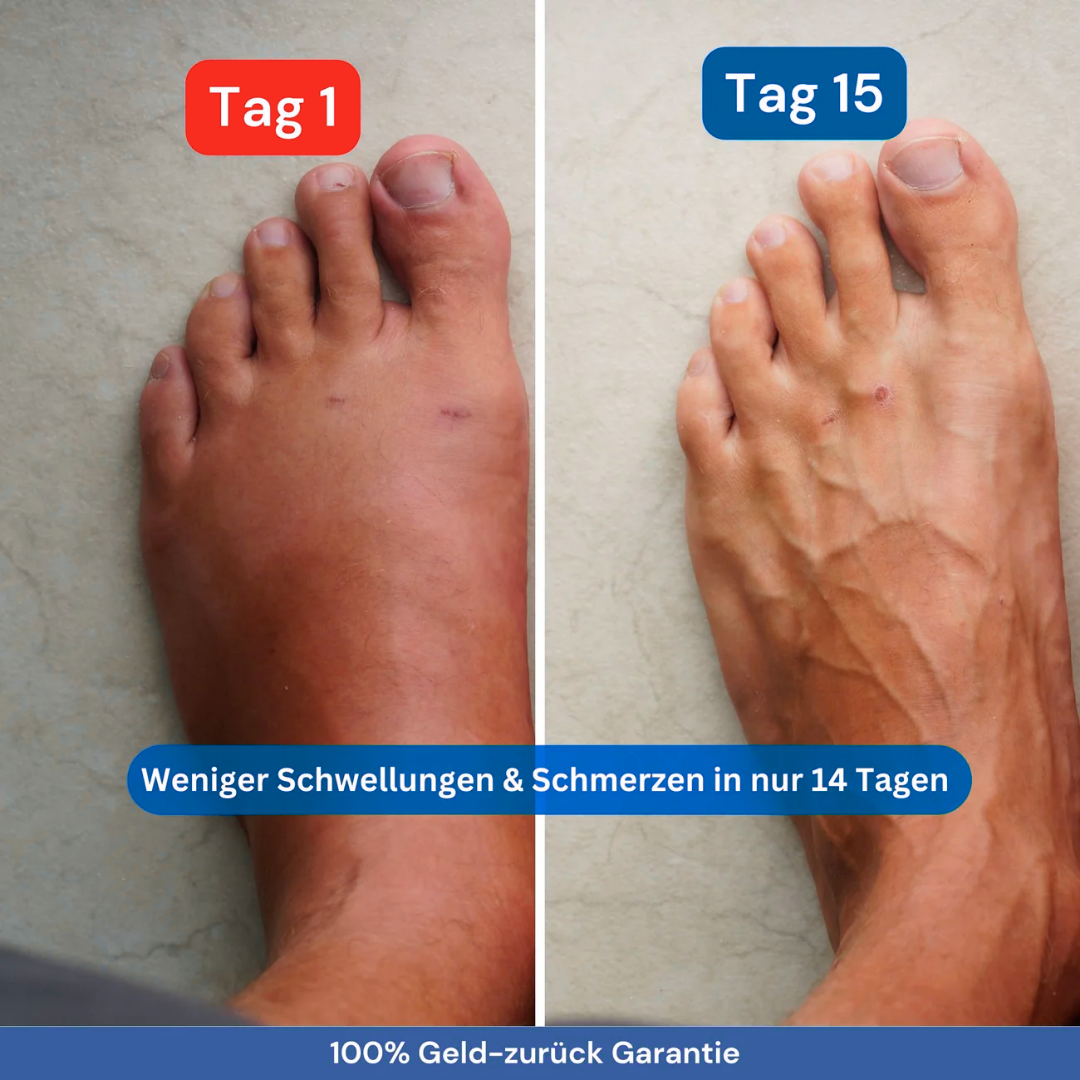 Ergonomische Kompressionsstrümpfe - Black Friday Aktion