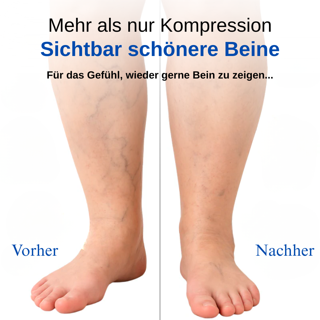 Ergonomische Kompressionsstrümpfe - Black Friday Aktion